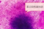 摸文物后住院7次 想想很吓人哦